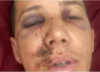Árbitro desabafa após ser agredido em Minas: “Poderia estar em cadeira de rodas”