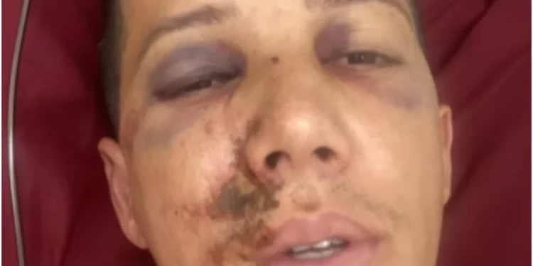 Árbitro desabafa após ser agredido em Minas: “Poderia estar em cadeira de rodas”